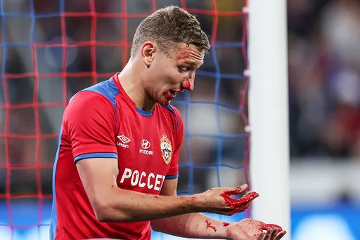 Защитник «Сочи», сломавший нос Чалову, пропустит 4 матча
